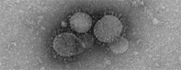 آخرین اخبار از ویروس کرونا در عربستان